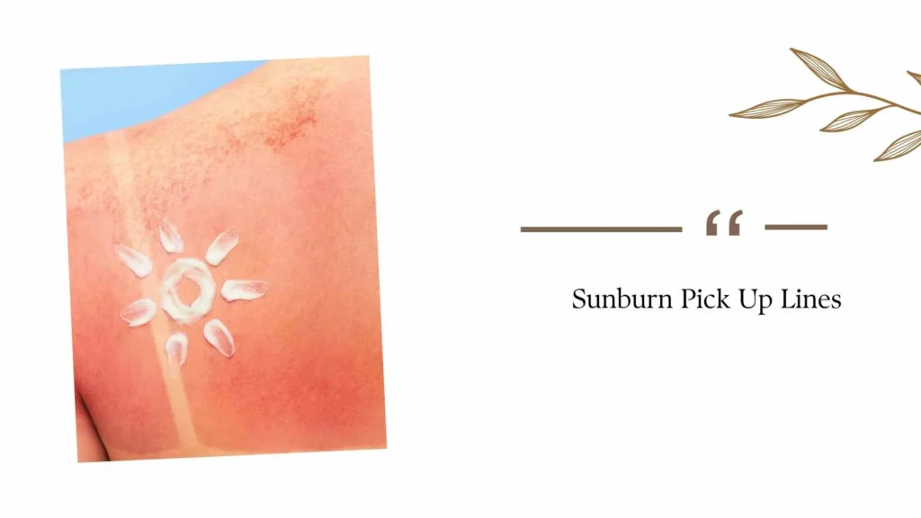 Sunburn Pick Up Lines